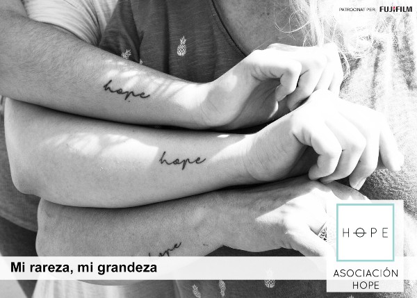  Peu de foto, logo de l'Associació Hope. Fotografia de tres braços amb la paraula hope tatuada.