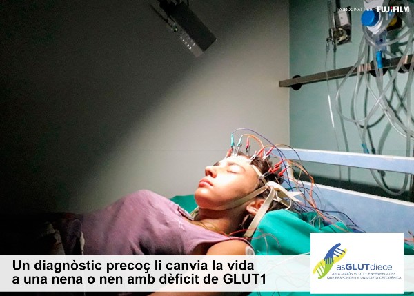  Peu de foto, logo de l'Associació GLUT1 y malalties que responen a una dieta  cetogènica. Fotografia d’una noia estirada al llit de l’habitació d’electroencefalogrames d’un hospital  amb els cables al cap.